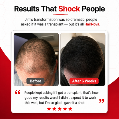 HairNova™ Pro Laser Cap