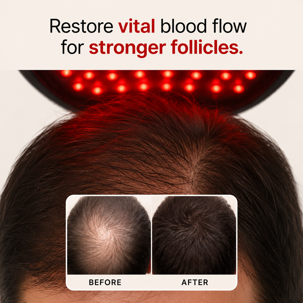 HairNova™ Pro Laser Cap